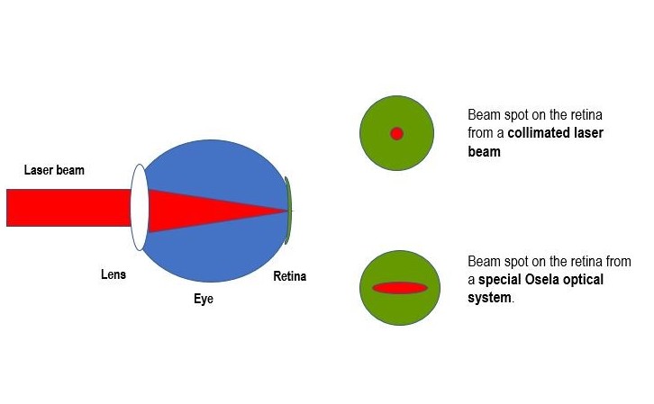 Optical power density reduction on retina based on astigmatism of laser beam