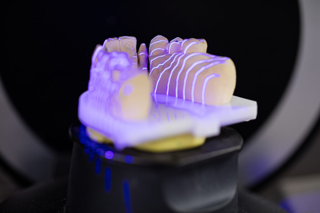 Dental crown mold inspection using structured light laser illumination